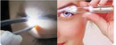 PinçaLux - Your illuminated tweezers to make your life easier