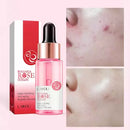 Rose Serum Glow — The Power of Rose for Radiant Skin