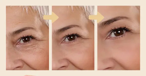 Gold Eye Lift - Gold Capsules for the Eye Area [BUY 1 GET 2 FREE] 