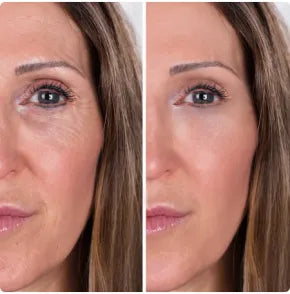 RetiGlow Anti-Aging Retinol Serum + Cream Kit [PROMOTION] 